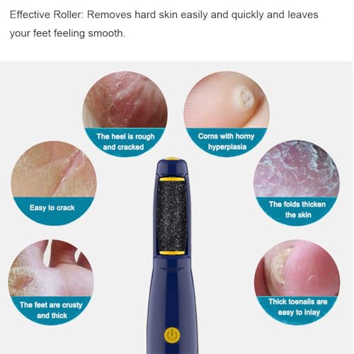 Replacement Roller Compatible with Dr. Scholl's Callus Remover Electronic Foot File-Extra Coarse (6 Pack)