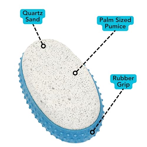 Iconikal 6-Pack Pumice Exfoliating Stone with Rubber Grip (Blue)