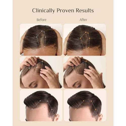 DR ZERO REDENICAL Hair Growth Shampoo for Women, 13.5 oz/400ml, Volumizing Thickening & Anti Hair Loss Regrowth Treatment, Clinically Tested for Hair Thinning with Redensyl, Japanese Hair Care Product