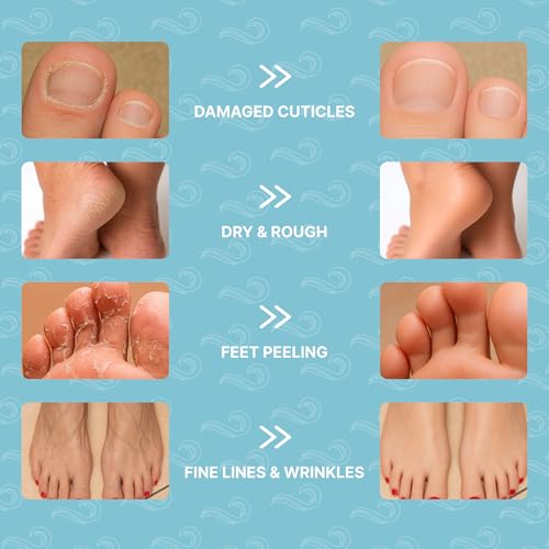 Foot Mask Moisturizing Socks for Dry Cracked Feet | Hydrates with Snail Mucin Shea Butter Hyaluronic Acid Bisabolol Vitamin E | Exfoliating Foot Mask for Callus Removal Dead Skin and Soft Feet