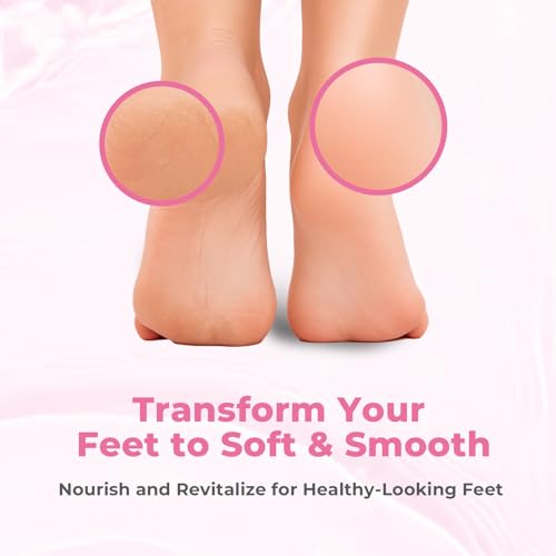 Foot Callus Remover with Foot File, Extra Strength Callus Remover Gel with Brush Head, Professional Dead Skin Removal for Feet, 8oz