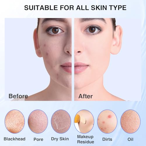 5 Modes Silicone Face Scrubber, Waterproof Face Scrubber Exfoliator for Men & Women, Rechargeable Electric Facial Cleansing Brush for Deep Cleansing, Exfoliating, Massage (Blue)