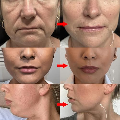 Double Chin Lifting Mask, Lift Chin Mask, Reusable Silicone Double Chin Strap Sleep Masks, Say Goodbye to Your Double Chin - Get a Sculpted Jawline in 3 Weeks (2PCS)