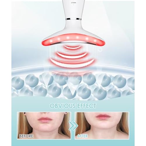7 Color Neck Face Massager - Facial Massager Tool for Skin Care at Home, Vibrating Face Massager with Thermals, Galvanic Machines White