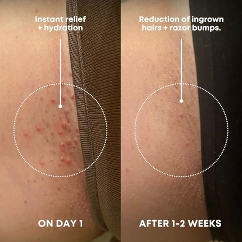 Bushbalm Ingrown Hair Exfoliating Scrub ? Pre-Shave Sugar Scrub for Ingrown Hairs, Razor Bumps & Dry Skin ? Gently Buffs & Soothes Sensitive Skin ? Nude, 236ml
