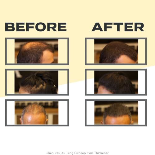 Hair Thickener | New Waterproof Formula - Natural & Fuller Looking Hair in 30 sec - 14g - Fibers for Thinning, Bald Spots & Graying Roots (Dark Brown)