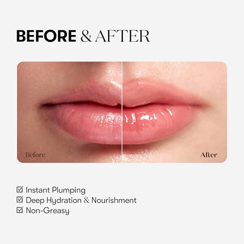 VT COSMETICS Reedle Shot Lip Plumper, Hydrating & Volumizing Clear Lip Gloss, Microneedling Effect & Hyaluronic Acid for Fuller, Smoother Lips, Stocking Stuffers, 0.15 oz (4.3 g) (Beginner)