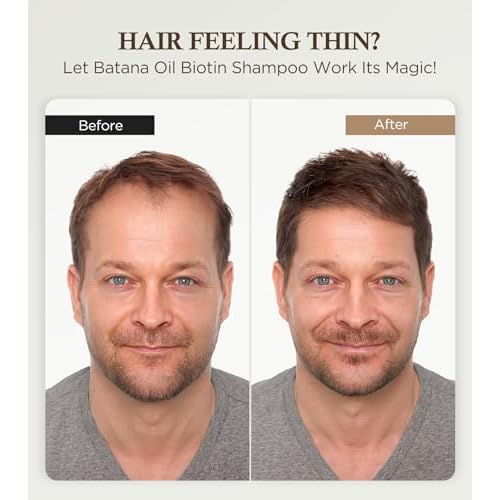 99% Pure Biotin Shampoo for 3X Thicker, Fuller Hair Growth, 80% Less Hair Loss w/Thuja Extract, Batana & Noni Fruit Oil Hair Care for Deep Nourishing,Rosemary Dandruff Treatment for Men Women,11.83oz