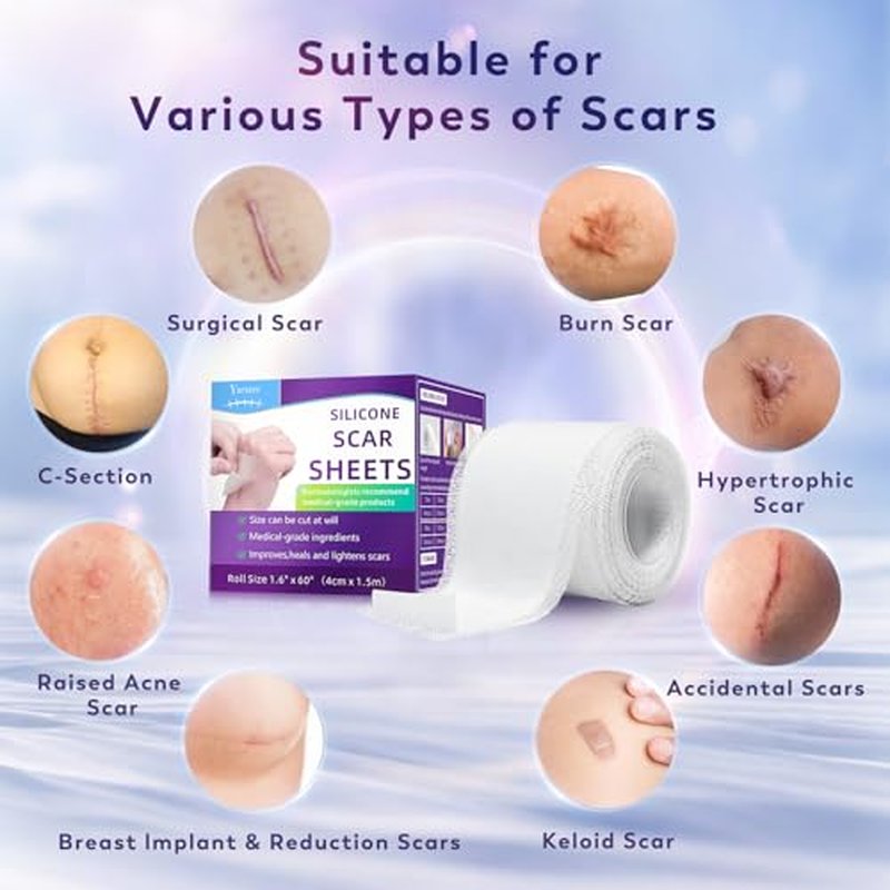 Silicone Scar Sheets, Silicone Scar Tape(1.8"x 157" Roll-4M), Medical Grade Scar Sheets, Scar Tape for Surgical Scars, Burn, C-Section, Keloid Scars, Acne Treatment, Stretch Marks Removal
