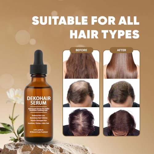 Dekohair Hair Regrowth Serum, Scalp Serum for Hair Growth, Protect Hair Follicles & Inhibit Hair Loss, Thickening and Healthier Scalp for Men & Women 2 Fl Oz (1)