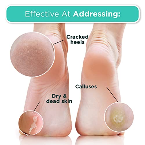 DERMORA Foot Peel Mask - 2 Pack of Regular Size Skin Exfoliating Foot Masks for Dry, Cracked Feet, Callus, Dead Skin Remover for Baby Soft Feet, Original Scent