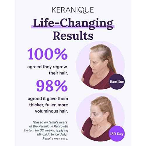 Keranique Hair Regrowth Treatment for Women - 2% Minoxidil for Hair Growth & Thickening - Topical Solution Scalp Treatment for Hair Loss & Thinning w/ Precision Spray Applicator - 2 Fl Oz