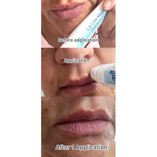 Lip Line Serum For Lines Above the Lips, Max Strength, With Hyaluronic Acid, Papaya Extract and Retinol