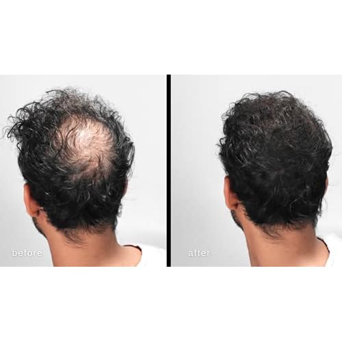 LUXE Hair Building Fibers - Thickening Fibers - CONFIDENCE IN A JAR ? 2 Months+ Supply! ? Hypoallergenic, Dermatologist Tested ? Multiple Colors Available (Dark Brown)