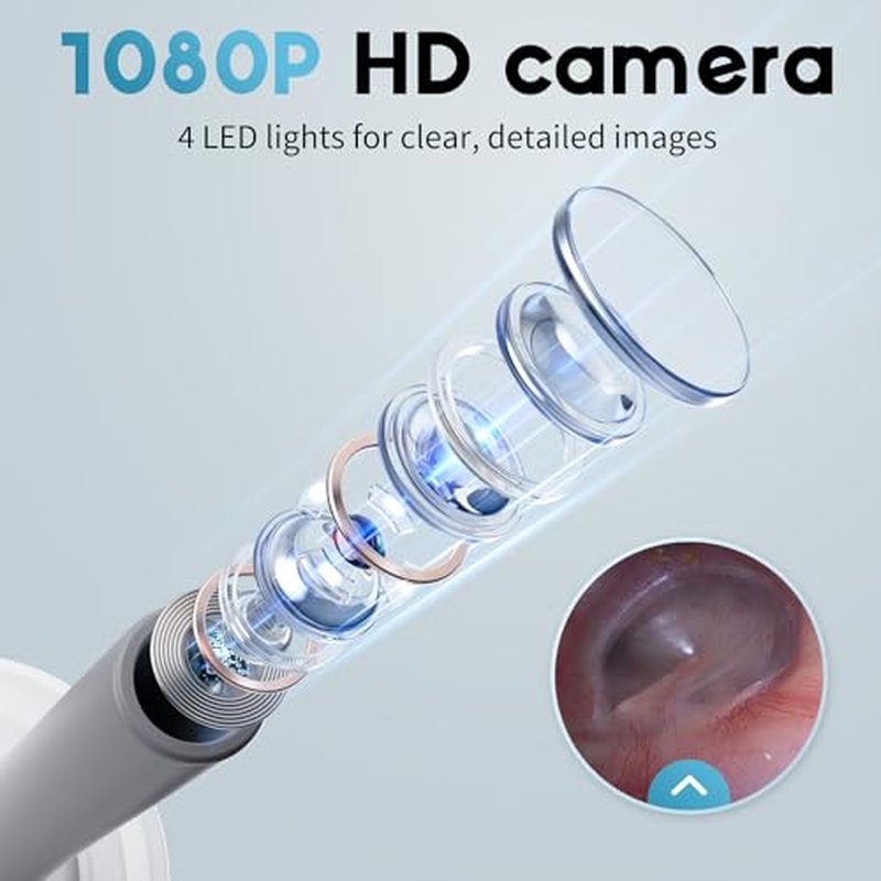 Otoscope Ear Camera with 1.21¡± Screen, 1080P HD Ear Scope with 4 LED Lights, Otoscope Camera for Adults Kids and Pets, Support Photo & Video, Type-C Charging with Computers, Baby Essentials