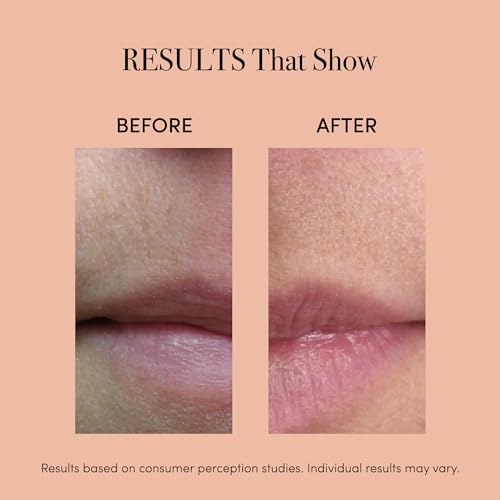 reVive Lux Collection Lip Plumper Device, LED Light Therapy Products for Lip Care, At-Home Infrared, Red & Amber Therapy for Smooth, Hydrated, Healthy-Looking Lips