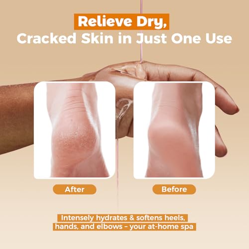 Paraffin Wax Refills 10 Packs Unscented for Paraffin Wax Bath Machine - for Dry Cracked Skin on Hands, Feet, Elbows - Moisturizing Hydration to Relieve Stiff Muscles & Joints