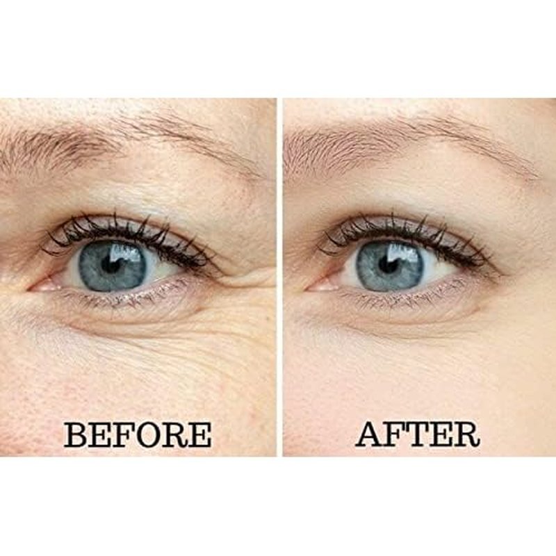 Osmotics Under Eye Rejuvenator, Anti Aging Eye Cream For Dark Circles, Eye Bags, Fine Lines, Puffiness. Best Anti Aging Eye Cream for Wrinkles, Crows feet, And Puffy Eyes