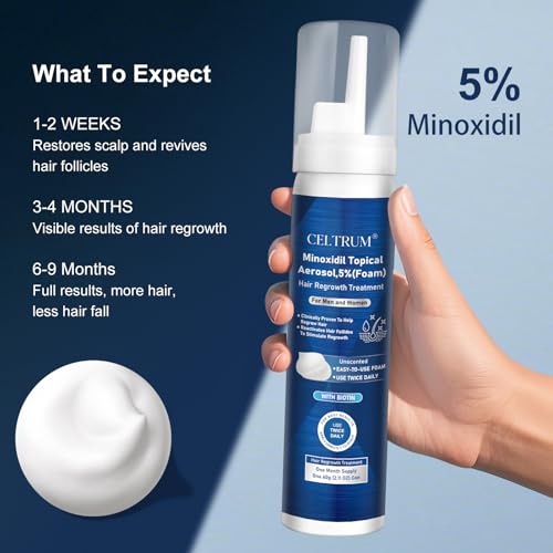 5% Topical Minoxidil Foam, Minoxidil for Men and Women, Infused with Biotin, Hair Growth Treatment, Supports Thicker and Fuller Hair & Beard (Minoxidil Foam, 8.44oz, 4 Month Supply)