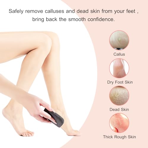 Natural Volcanic Pumice Stone for Feet Pumice Cleaning Stone for Sole of The Foot,Edges of The Foot,Toe Seams Deep Clean,Foot Scrubber for Dead Skin Remover 3 Shapes
