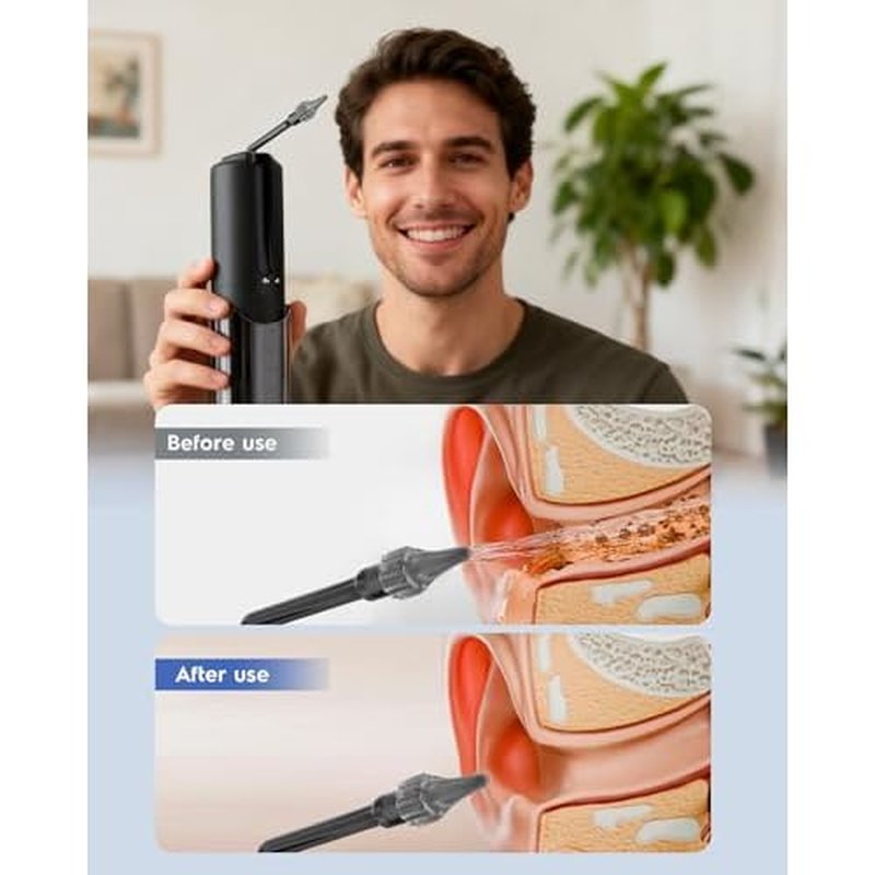 Upgraded Ear Wax Removal, Electric Ear Cleaner, Safe and Efficient Ear Cleaning, 4 Pressure Modes, 10 nozzles, Electric Earwax Cleaning Kit for Earwax Buildup