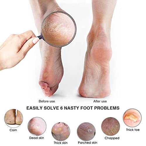 Pumice Stone Foot File (2-Pack), Wooden Handle Foot Scrubber & Callus Remover for Dry, Rough Skin and Corns Pedicure