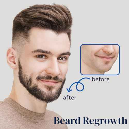 5% Minoxidil for Men Hair, Minoxidil for Women Hair Growth, Minoxidil Hair Growth Spray 2PCS.