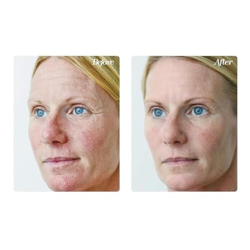 Osmotics Blue Copper 5 Firming Elasticity Repair ? Cream for Firmness and Acne. Visible Results, Made in the USA