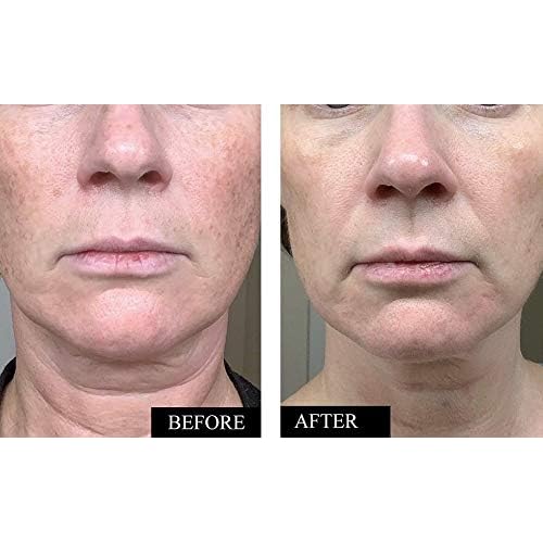 Vitamin C Serum for Face | Brightening & Anti Aging Serum for Men & Women | With Hyaluronic Acid, Vitamin E, Aloe & Jojoba | Dark Spot & Wrinkle Reducer | Made in USA | 1.7 oz | 2 Pack