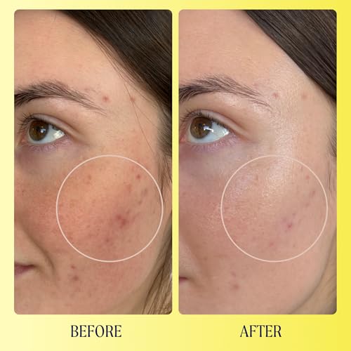 Kinship Brightwave Brightening 10% Vitamin C Serum for Face | Peptide Serum Dark Spot Corrector | Vegan Collagen Anti Aging Skincare | Smooth Fine Lines | Reduce Wrinkles (1 Fl Oz)