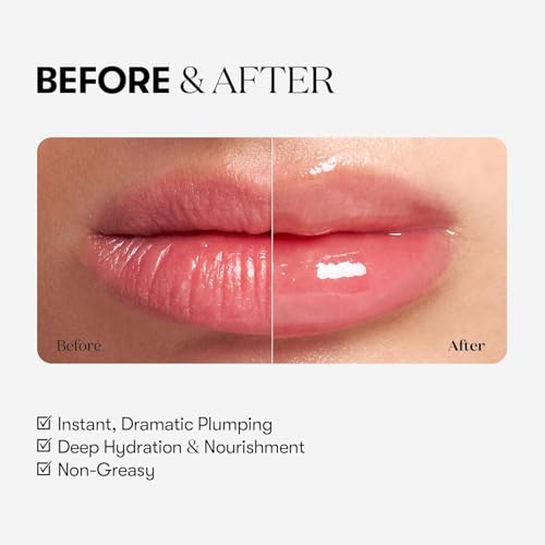 VTCOSMETICS Reedle Shot Lip Plumper, 0.15 oz (4.3 g), Moisturizing, Transparent, Lip Gloss, Stocking Stuffers, Fragrance-free, Korean Cosmetics (Expert)