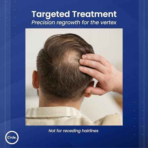 Minoxidil for Men Foam 5% - Unscented 3 Month Supply - Helps Restore Vertex Hair Loss & Thinning - 5% Minoxidil Foam For Men - Extra Strength Supports Hair Regrowth