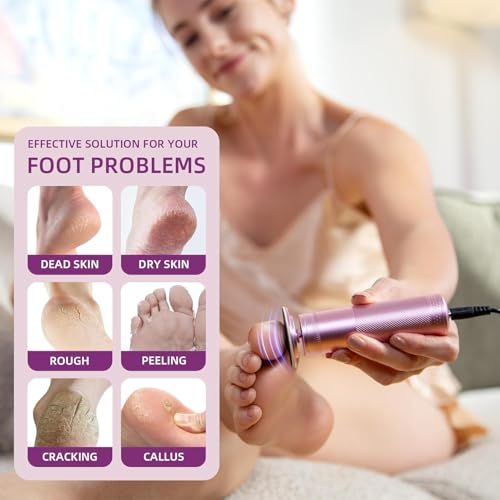 Electric Foot Callus Remover: Feet File Callus Remover with 60pcs Sandpaper Discs - Dead Hard Skin Foot Scrubber for Women -3 Adjustable Speed Pedicure Tools for Feet