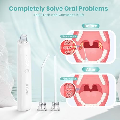 Tonsil Stone Remover with 5X Magnifying Glass Tonsil Stone Removal Kit 3 Suction Modes LED Light Bad Breath Water Flosser