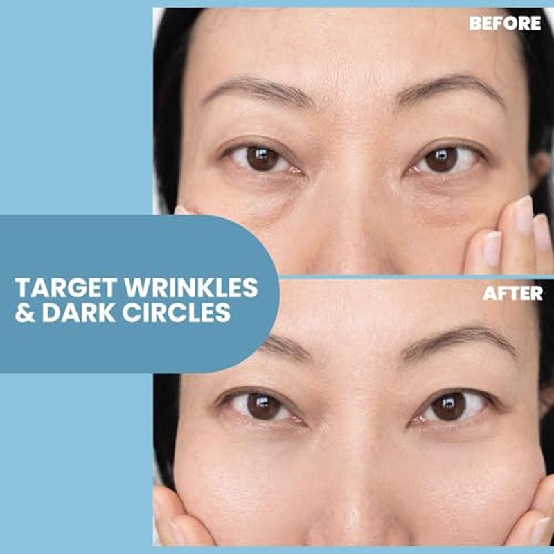 Eva Naturals Eye Gel for Dark Circles, Bags & Puffiness ? Anti-Aging Serum with Peptides, Hyaluronic Acid & Botanicals ? Firming Under Eye Treatment for Wrinkles, Fine Lines & Tired Skin ? 2 oz