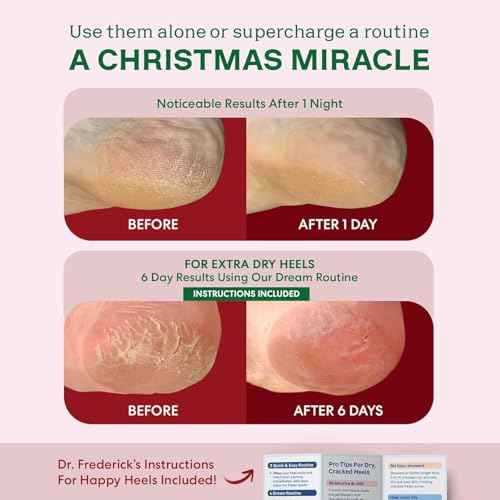 Dr. Frederick's Original Moisturizing Fuzzy Heel Socks - 3 Pairs - Cozy Gel-Lined Sleep Socks for Women & Men - Soothing Dry, Cracked Feet - Cracked Heel Repair (Holiday Special Edition)