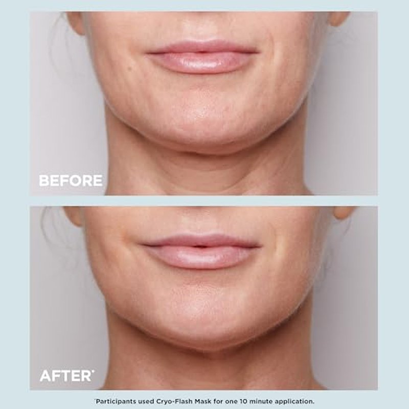 CLARINS Cryo-Flash Face Mask | Visible Lift Effect in 10 Minutes* | Visibly Minimizes Pores | Boosts Radiance | Pro Like Results | All Skin Types