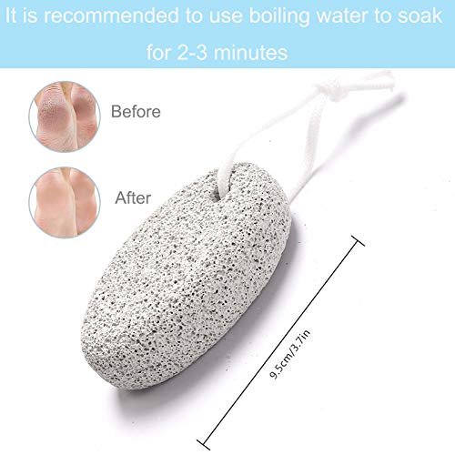 Natural Foot Pumice Stone for Feet, Borogo 5-Pack Lava Pedicure Tools Hard Skin Callus Remover for Feet and Hands - Natural Foot File Exfoliation to Remove Dead Skin, Heels, Elbows, Hands