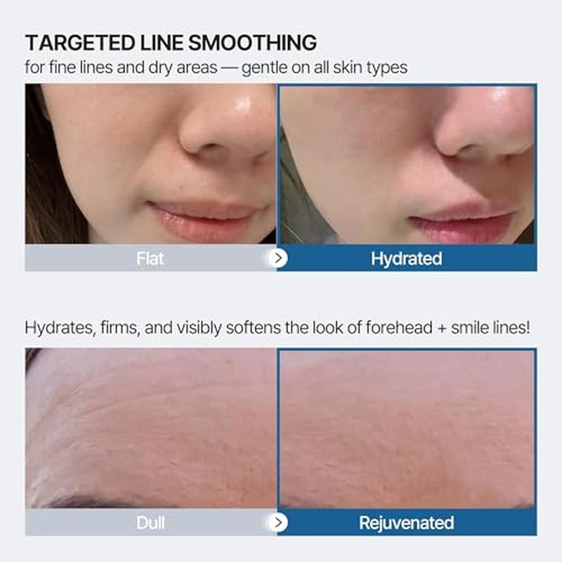Honeydew Labs Forehead Wrinkle Patches and Smile Line Patches with Retinol, Collagen, Peptides- Anti Wrinkle Patches - Face Tape Overnight Wrinkle Treament for Woman for Smoothing and Firming (36PCS)