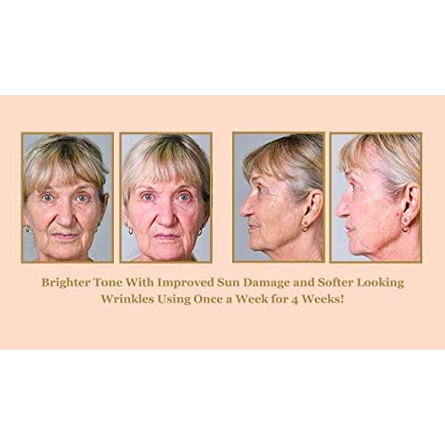 DIAMONDBUFF Microderm Exfoliation Tool for at Home Glowing and Radiant Skin | Reduce Acne, Fine Lines, Wrinkles, & Provide a Velvety Smooth Complexion with Diamond Microdermabrasion