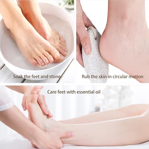 2PCS Natural Foot Pumice Stone£¬Natural Lava Pumice Stone for Feet, Foot Scrubber£¬Effective Pedicure Tools for Dead Skin and Callus Removal (Grey)