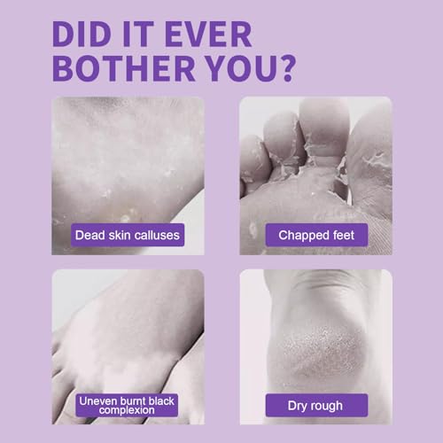 Foot Peeling Mask - 5 Pack Exfoliating Foot Peel Mask for Dry Cracked Feet - Baby Soft Foot Mask Socks for Removing Dead Skin, Cracked Heels, and Calluses - Lavender, Shea Butter, Aloe - Women and Men