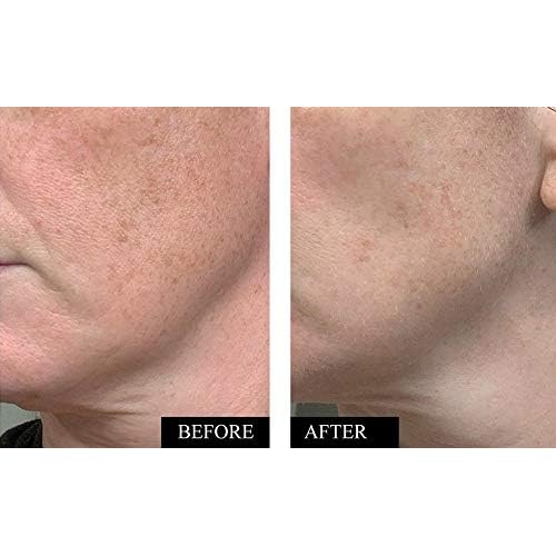 Vitamin C Serum for Face | Brightening & Anti Aging Serum for Men & Women | With Hyaluronic Acid, Vitamin E, Aloe & Jojoba | Dark Spot & Wrinkle Reducer | Made in USA | 1.7 oz | 2 Pack