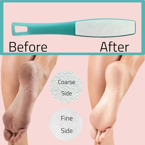 1 ALAZCO Double Sided Foot File Pumice Ergonomic Handle Scrubber Immediate Result Smooth Feet Heel Scraper Exfoliate Buffer Dead Skin Callus Corn Emery Fine & Coarse Pedicure Tool