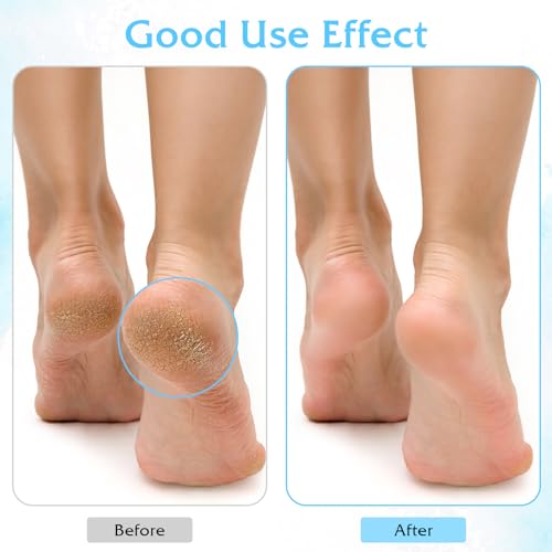 3Pairs Aloe Socks Moisturizing Spa Socks for Dry Cracked Feet Infused Socks Gel Sleeping Fuzzy Socks Lotion Socks Gift for Women Softening Dry Feet, Pink&blue&green