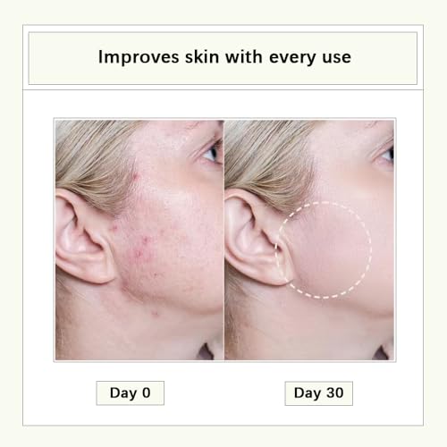 Cistto Natural Cleansing Oil Lightweight Balancing Makeup Remover with Jojoba & Rose Oil, Non-Comedogenic, Travel-Friendly 2ml x 40 Capsules for Oily Skin