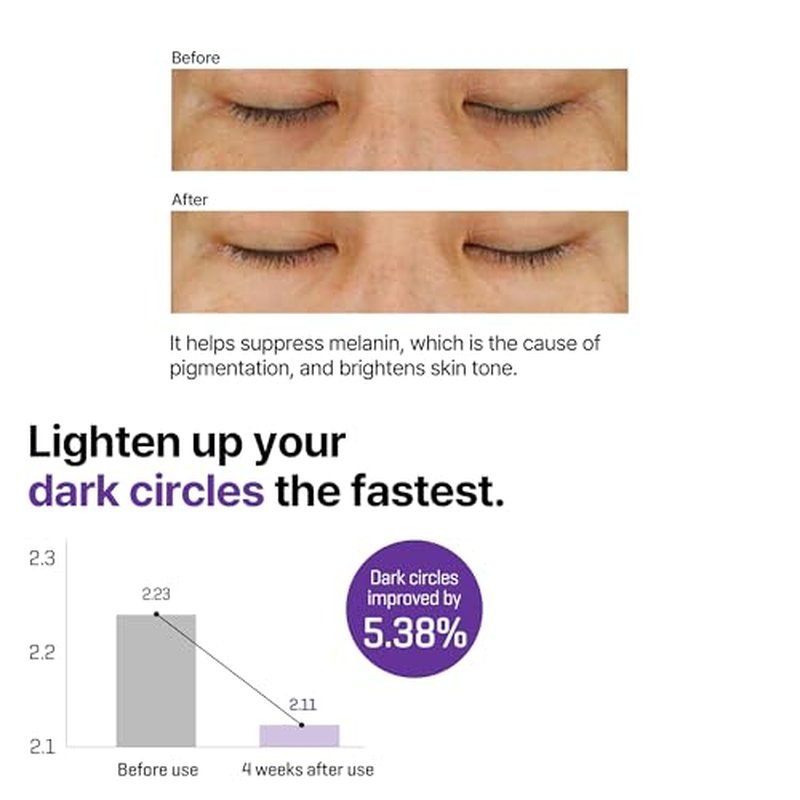 SOME BY MI Retinol Intense Advanced Triple Action Eye Cream ? 1.01Oz, 30ml ? Korean Retinol Under Eye Cream Anti Aging for Fine Lines ? Brightens Dark Circles & Smooths Skin Texture ? Korean Skin Care