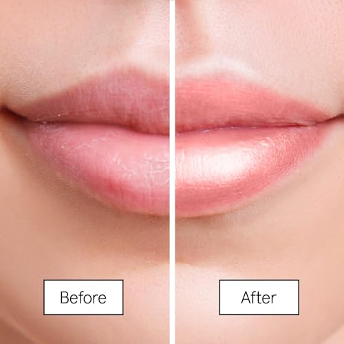 grace & stella Award Winning Lip Butter - Hydrating Lip Balm - Nourishing Lip Mask (1-pack) Travel Essentials, Travel Size Toiletries, Birthday Gifts for Women & Teens - Overnight Lip Repair - Vegan