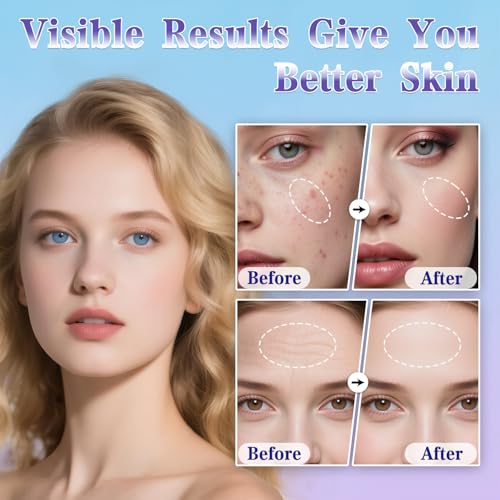 Derma Stamp - Uaike Microneedling Derma Stamp for Hair, Beard, Scalp & Face, Home Use Microneedle Roller Dermastamp for Women and Men