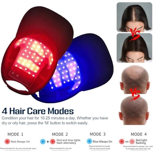 SweetOnes Premium Hair Regrowth Loss Care Treatments Supplyment Products AD-2